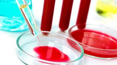 Blood testing for parasites