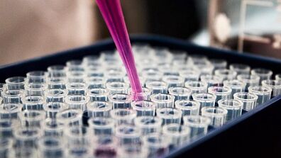 How to make tests to recognize parasites in the body